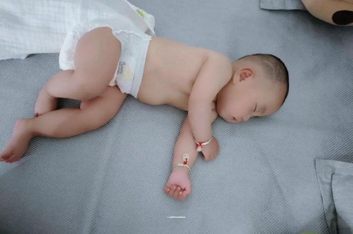 宁波宝宝褶皱处擦粉还是油